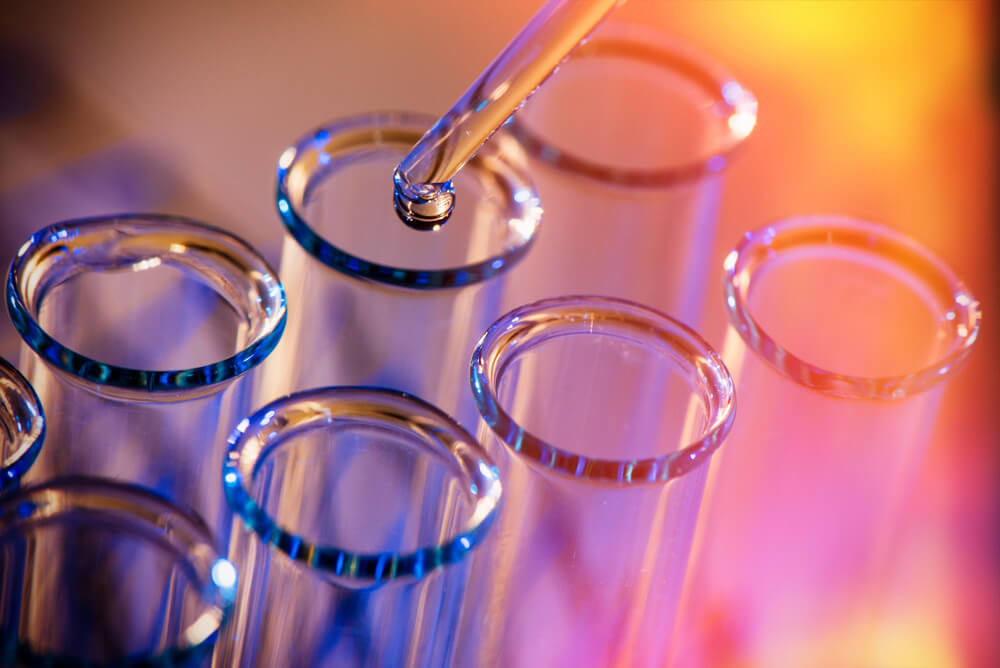 Lab test